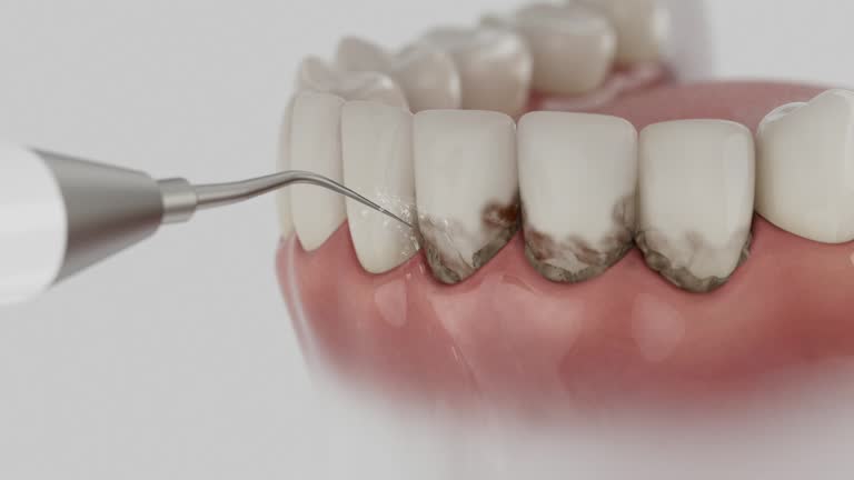 Trusted Tooth Extraction service in Brooklyn, IA - Dentist Open Now